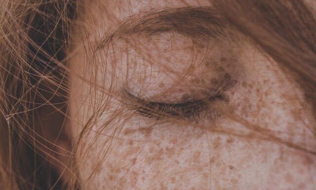 Este posibil sa eliminati pistruii in mod complet natural?